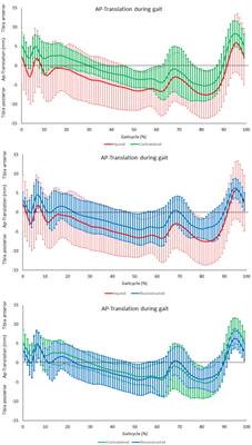 Altered knee kinematics after posterior cruciate ligament single-bundle reconstruction—a comprehensive prospective biomechanical in vivo analysis